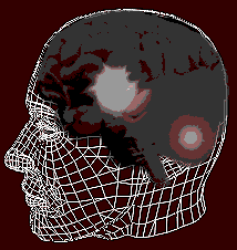 Brain Activity Reboot Phase 2